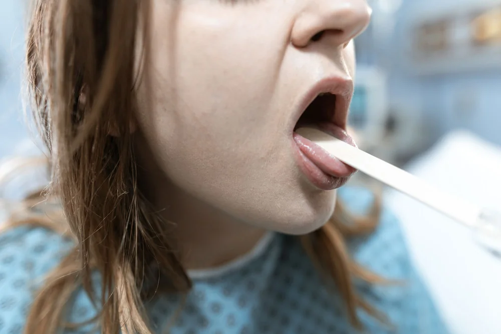 Mouth Sores and Canker Sores: When Should You See a Dentist?
