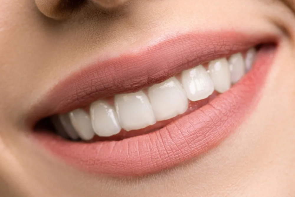 What Is Gum Aesthetics (Pink Aesthetics)? Methods and Applications