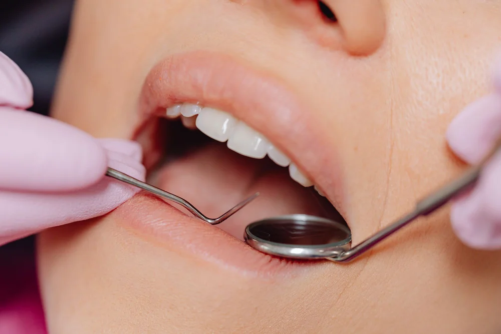What Is Gum Inflammation (Gingivitis)? Symptoms and Treatment