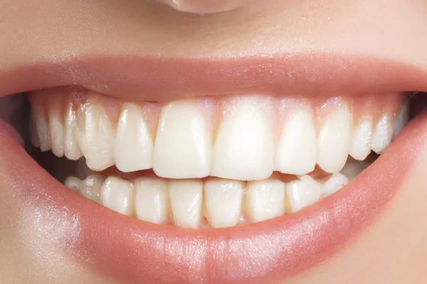 What Is a Gummy Smile? Causes and Treatment Approaches