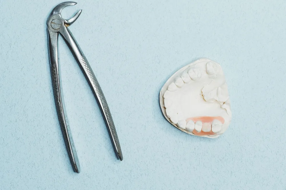 What Is Dry Socket (Alveolar Osteitis)? Severe Pain After Extraction