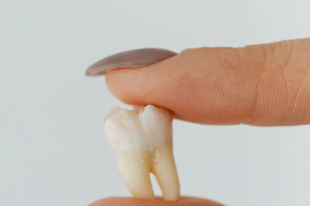 Does Orthodontic Treatment Require Tooth Extraction?