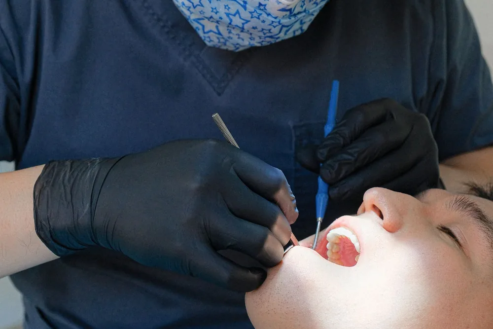 What Is Periodontitis? Symptoms and Treatment Options